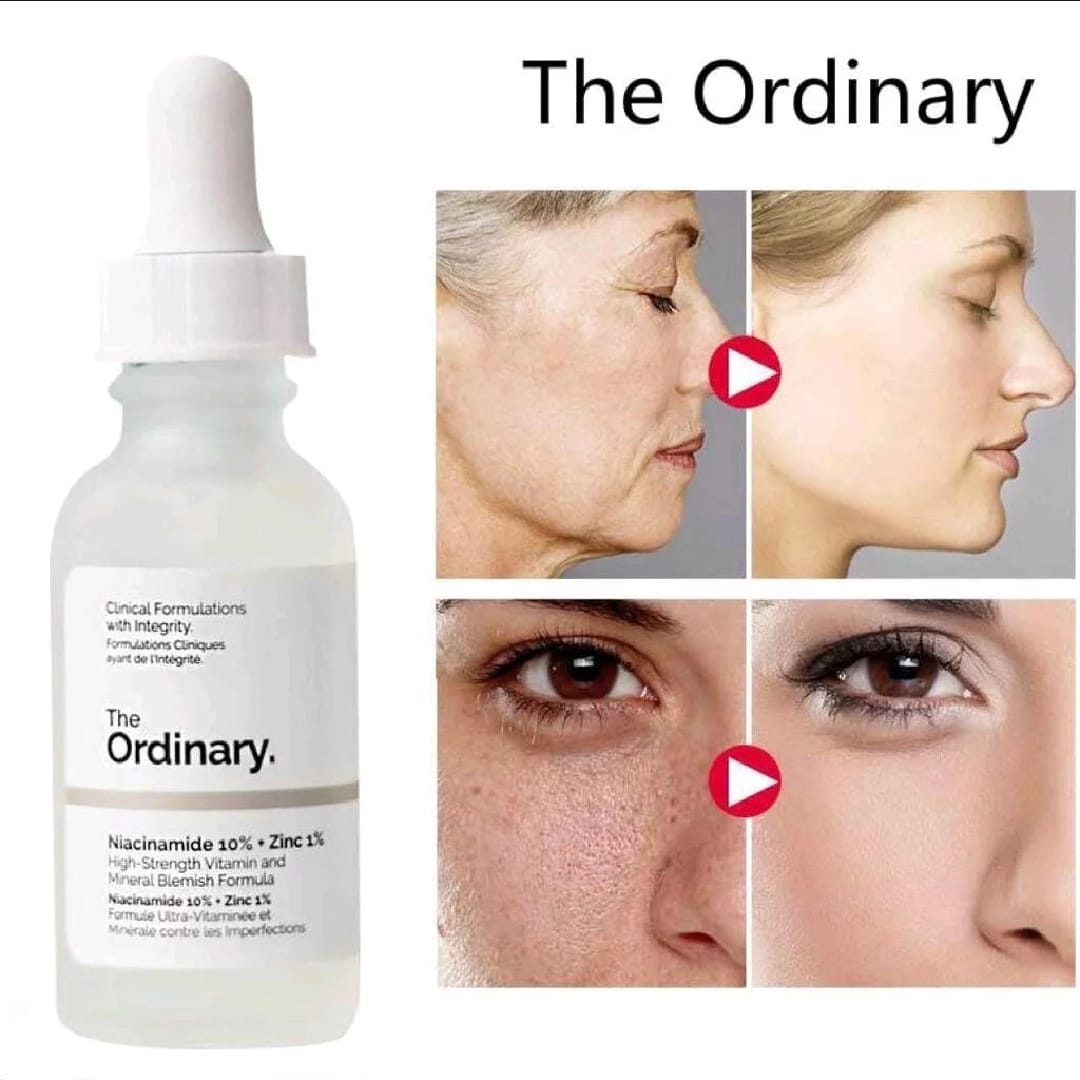 Facial Treatment Hyaluronic Acid & Niacinamide Serum - Brightens, Hydrates, Reduces Skin Blemishes, Vegan, Paraben-Free, Cruelty-Free, 30ml